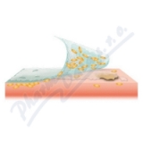 Cutimed Sorbact gel 7. 5x7. 5cm antimikrob. kr. 10ks